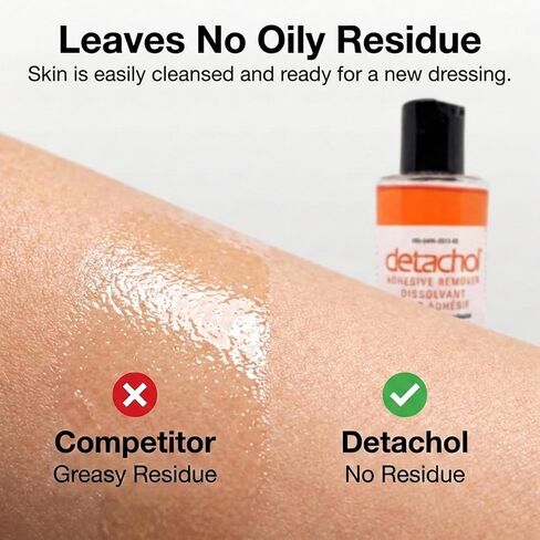 مزيل لاصق - زجاجة 8 أوقية لإزالة آمنة وسهلة للمواد اللاصقة الطبية والضمادات وشريط الجلد - خالي من الكحول والأسيتون - لطيف على البشرة الحساسة in Kuwait