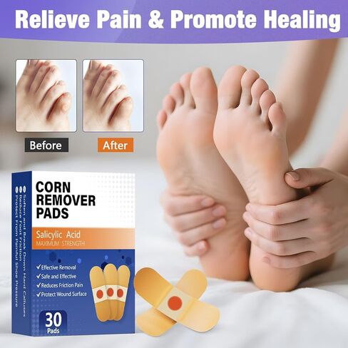 Corn Remover Pads for Toes and Feet, Maximum Strength 40% Salicylic Acid Medicated Treatment - Fast-Acting Adhesive Patches for Corn, Callus & Dead Skin Removal, 30 Count in Kuwait