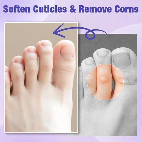 Corn Remover Pads for Toes and Feet, Maximum Strength 40% Salicylic Acid Medicated Treatment - Fast-Acting Adhesive Patches for Corn, Callus & Dead Skin Removal, 30 Count in Kuwait