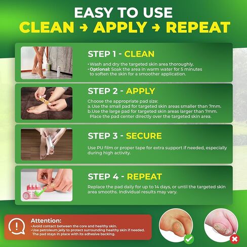 Corn Remover Pads for Feet Toes: 30-Pack Salicylic Acid Extra Strength Treatment - Fast Effective Medicated Bandages for Kids Adults Seniors Teens Athletes Runners Hikers Workers Men Women in Kuwait