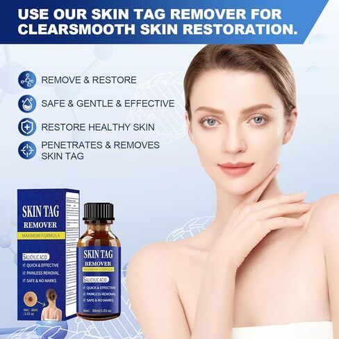 Fast-Acting Skin Tag Remover for Body and Neck - Natural, Mild Salicylic Acid Formula, Use a Brush applicator Skin tag Remover Precisely and painlessly and Quickly.Safe for Sensitive skin30ML in Kuwait