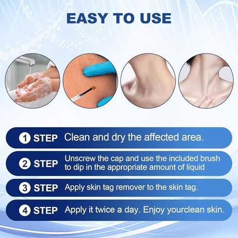 Fast-Acting Skin Tag Remover for Body and Neck - Natural, Mild Salicylic Acid Formula, Use a Brush applicator Skin tag Remover Precisely and painlessly and Quickly.Safe for Sensitive skin30ML in Kuwait