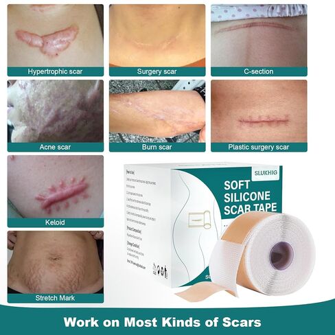 Silicone Scar Sheets (1.6"x 158" Roll-4M), Silicone Scar Tape for Scar Removal Treatment, Reusable Silicone Scar Strips for C-Section, Keloid, Burn, Acne, Surgical Scars in Kuwait