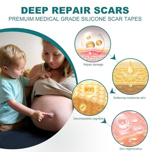 Silicone Scar Sheets (1.6"x 158" Roll-4M), Silicone Scar Tape for Scar Removal Treatment, Reusable Silicone Scar Strips for C-Section, Keloid, Burn, Acne, Surgical Scars in Kuwait