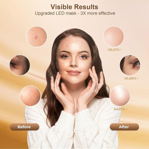 Red Light Therapy for Face, LED Face Mask Light Therapy, Rechargeable Red Light Therapy Mask for Face with Comfortable Light-Blocking Eye Protection & Timing Function At Home, Black in Kuwait