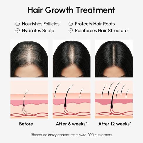 زيت ماري باتانا لنمو الشعر - زيوت بوتانا طبيعية 100% لنمو الشعر - معجون زيت باتاما الخام من هندوراس - الكثافة والسمك ومهدئ فروة الرأس للنساء والرجال - Aceite de Batana Para el Cabello in Kuwait