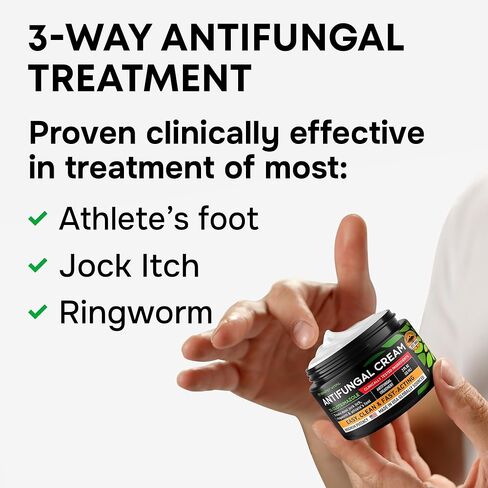Clotrimazole Antifungal Cream - Treats Most Athlete’s Foot, Jock Itch, Ringworm - Clotrimazole 1% Anti Fungal Cream for Skin, Athletes Foot Treatment, Ring Worm Medication for Humans - 2oz Made in USA in Kuwait
