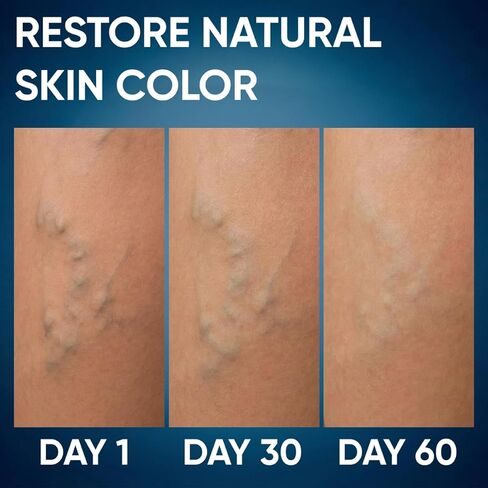 ثنائي الساق - كريم نباتي وأقراص عشبية لدعم الدورة الدموية والحيوية والعافية - تركيبة أشواغاندا لتعزيز وظيفة الساق الصحية in Kuwait