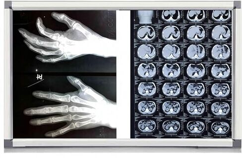 صندوق إضاءة LED بالأشعة السينية للعيادات الطبية والمستشفيات، سطوع قابل للتعديل، خالي من الوميض، إطار من الأكريليك والألومنيوم، 33 × 19 بوصة، موفر للطاقة، مثالي للأشعة السينية لتقويم العظام والأسنان in Kuwait