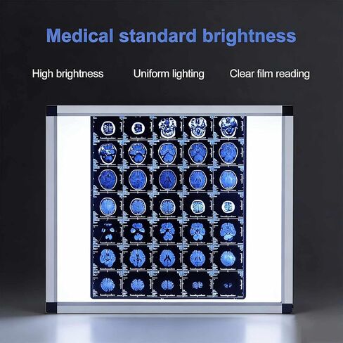 صندوق إضاءة LED بالأشعة السينية للعيادات الطبية والمستشفيات، سطوع قابل للتعديل، خالي من الوميض، إطار من الأكريليك والألومنيوم، 33 × 19 بوصة، موفر للطاقة، مثالي للأشعة السينية لتقويم العظام والأسنان in Kuwait