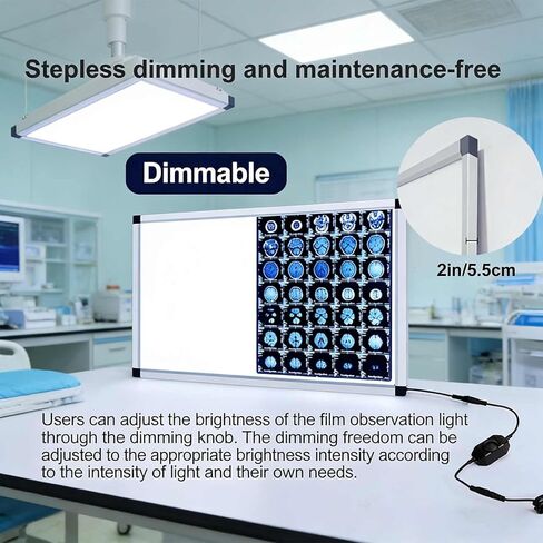 صندوق إضاءة LED بالأشعة السينية للعيادات الطبية والمستشفيات، سطوع قابل للتعديل، خالي من الوميض، إطار من الأكريليك والألومنيوم، 33 × 19 بوصة، موفر للطاقة، مثالي للأشعة السينية لتقويم العظام والأسنان in Kuwait