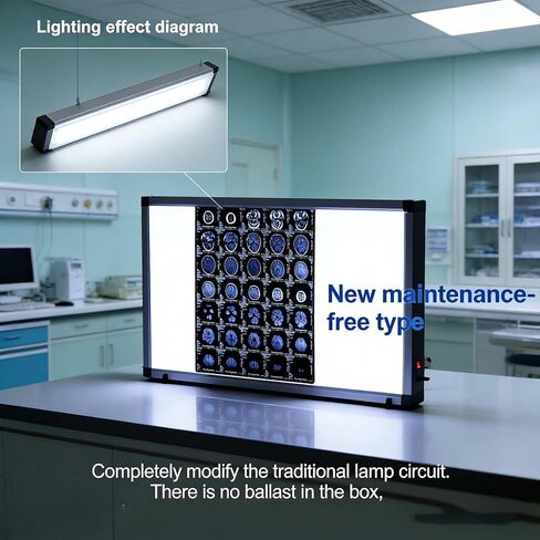 صندوق إضاءة LED بالأشعة السينية للعيادات الطبية والمستشفيات، سطوع قابل للتعديل، خالي من الوميض، إطار من الأكريليك والألومنيوم، 33 × 19 بوصة، موفر للطاقة، مثالي للأشعة السينية لتقويم العظام والأسنان in Kuwait