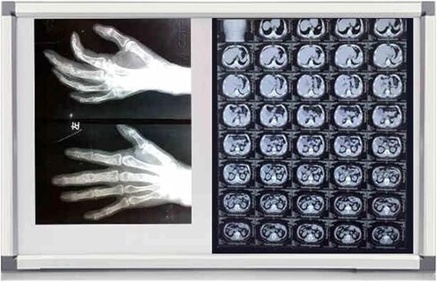 صندوق إضاءة LED بالأشعة السينية، سطوع قابل للتعديل، عارض خالٍ من الوميض للعيادات الطبية والمستشفيات، إطار متين من الأكريليك والألومنيوم، معدات مختبر مقاس 33 × 19 بوصة in Kuwait