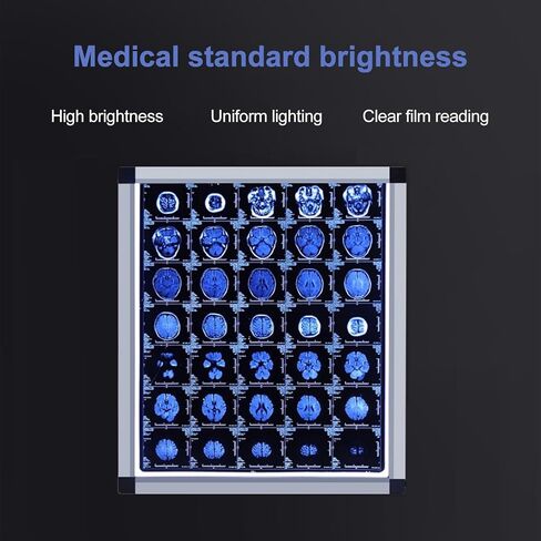 صندوق إضاءة LED بالأشعة السينية، سطوع قابل للتعديل، عارض خالٍ من الوميض للعيادات الطبية والمستشفيات، إطار متين من الأكريليك والألومنيوم، معدات مختبر مقاس 33 × 19 بوصة in Kuwait