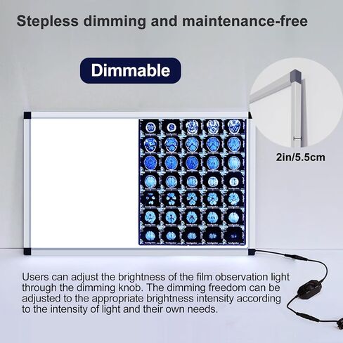 صندوق إضاءة LED بالأشعة السينية، سطوع قابل للتعديل، عارض خالٍ من الوميض للعيادات الطبية والمستشفيات، إطار متين من الأكريليك والألومنيوم، معدات مختبر مقاس 33 × 19 بوصة in Kuwait