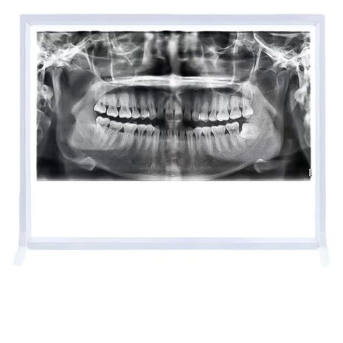 X Ray LED Film Viewer, Wall Mounting X-Ray Film Illuminator Light Box, Dental Illuminator Box Portable, Adjustable Brightness, Flicker-Free, No Shadows, for Lab Equipment (Remote Dimming) in Saudi Arabia