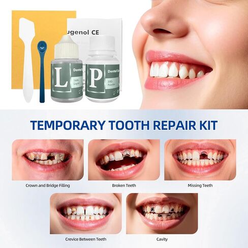 Tooth Repair Kit, Zinc Oxide Eugenol Cement for Cavities Filling, Dental Care Kit for Broken, Chipped or Missing Teeth, Temporary and Permanent Tooth Filling and Crown Fixing at Home in Kuwait