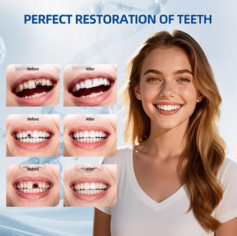 Tooth Repair Kit, Zinc Oxide Eugenol Cement for Cavities Filling, Dental Care Kit for Broken, Chipped or Missing Teeth, Temporary and Permanent Tooth Filling and Crown Fixing at Home in Kuwait