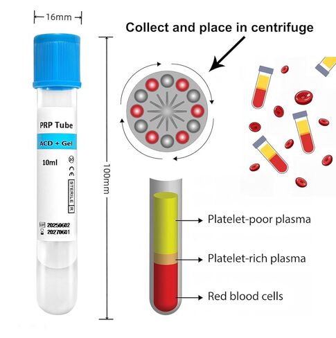 12in1 PRP Kit CE Certified Sealed Packaging Includes 2 15mL Tubes 10 Accessories (1) in Kuwait
