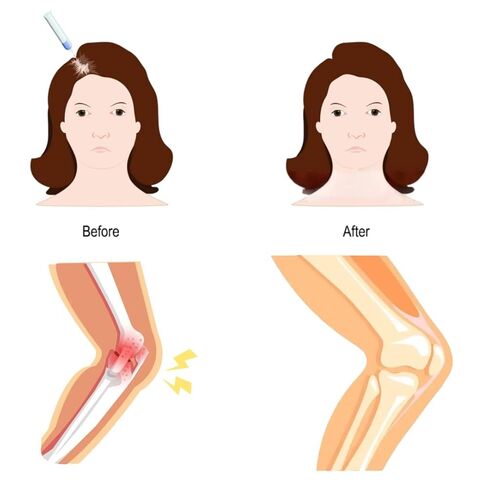 12in1 PRP Kit CE Certified Sealed Packaging Includes 2 15mL Tubes 10 Accessories (1) in Kuwait