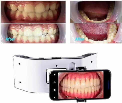 Dental Mobile Phone Fill Light, Dental Oral LED Photography Kits, 3 Group Lights Adjusted Independently & 3D Surround Lighting Design, for Home Salon and Macro Photography in Kuwait