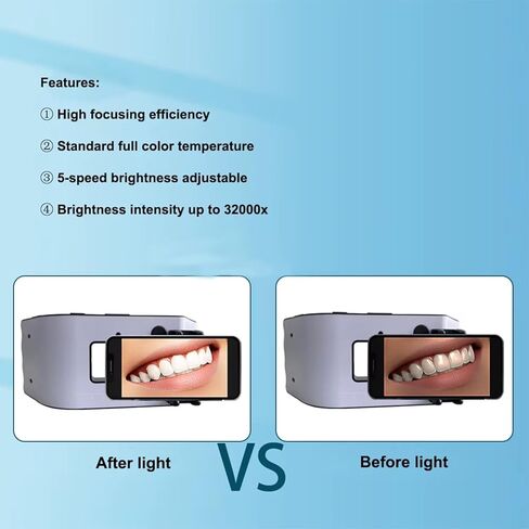 ضوء التصوير الفوتوغرافي للأسنان المحمول، ضوء ملء التصوير الفوتوغرافي للأسنان مع حامل ثلاثي القوائم ومشبك الهاتف المحمول، تصميم الإضاءة المحيطية ثلاثية الأبعاد ونطاق درجة حرارة اللون 3800K-6200K لعلاج طبيب الأسنان in Kuwait