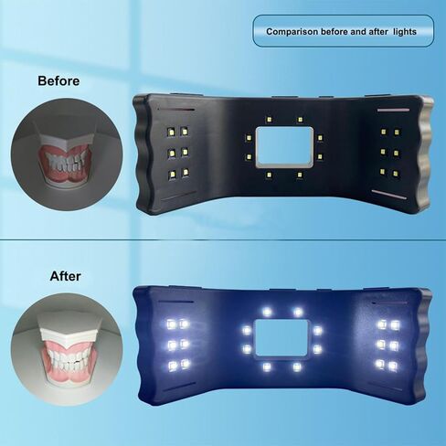 ضوء التصوير الفوتوغرافي للأسنان المحمول، ضوء ملء التصوير الفوتوغرافي للأسنان مع حامل ثلاثي القوائم ومشبك الهاتف المحمول، تصميم الإضاءة المحيطية ثلاثية الأبعاد ونطاق درجة حرارة اللون 3800K-6200K لعلاج طبيب الأسنان in Kuwait