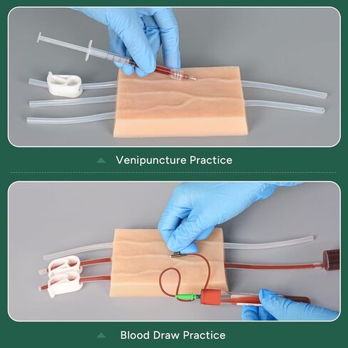 Ultrassist IV Injection Practice Kit, Venipuncture & IV Insertion Training Set, Phlebotomy Practice Simulator for Nursing Students Educational Use Only in Kuwait