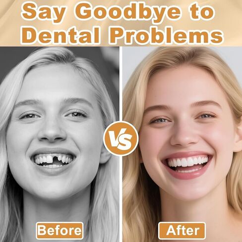 Moldable False Teeth, Dentures for Women and Men, Upper and Lower Silicone Denture Set, Fix your Smile in Minutes, 1PCS in Kuwait