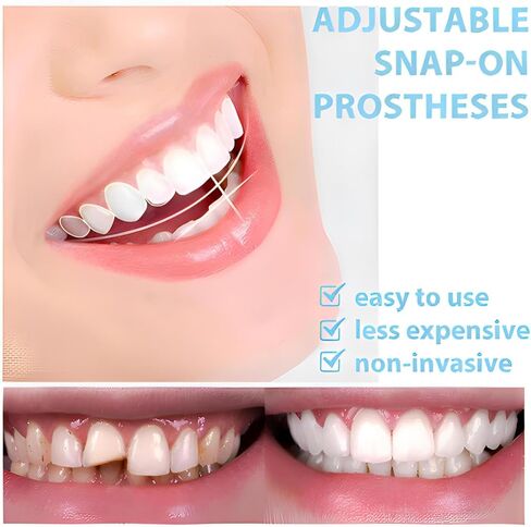 2 Pairs Temporary Smile Support Adjustable for All Genders Naturally and Comfortably Fit Restore Your Confident Smile (Upper/Lower) in Kuwait