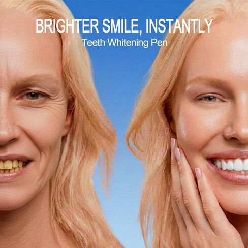Teeth Whitening Pen 4-Pack, 35% Carbamide Peroxide Whitening Gel Pens for Sensitive Teeth, Instant Whitening Essence for Stained Teeth, Removes Coffee, Wine & Smoking Stains in Kuwait