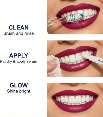 Teeth Whitening Pen 4-Pack, 35% Carbamide Peroxide Whitening Gel Pens for Sensitive Teeth, Instant Whitening Essence for Stained Teeth, Removes Coffee, Wine & Smoking Stains in Kuwait