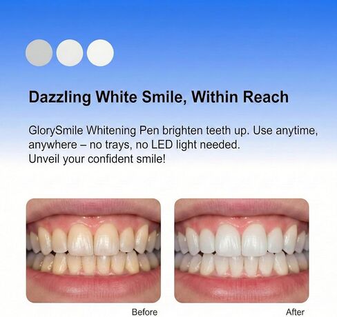 Teeth Whitening Pen 4-Pack, 35% Carbamide Peroxide Whitening Gel Pens for Sensitive Teeth, Instant Whitening Essence for Stained Teeth, Removes Coffee, Wine & Smoking Stains in Kuwait