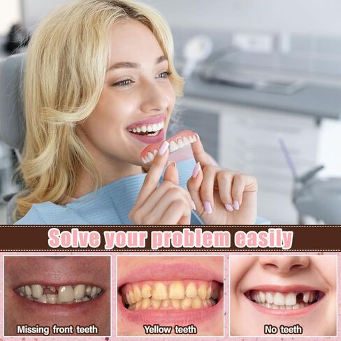 Snap on Veneers for Women & Men | Natural-Looking Top & Bottom Fake Teeth | Comfortable & Easy to Use in Kuwait