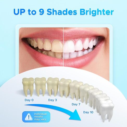 Luelli Teeth Whitening Pen, 50+ Uses - Travel Size Professional Tooth Whitener Gel, Extra Strength Organic Teeth Bleaching Gel for Sensitive Teeth, Instant Stain Removal, Simply White Smile, 4 Count in Kuwait