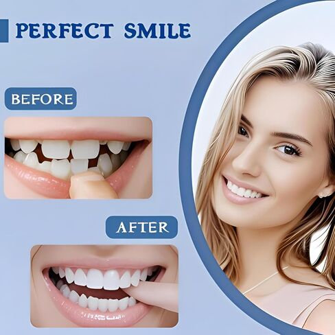 Veneers Teeth for Women, Tooth Replacement Kit, Nature and Comfortable in Kuwait