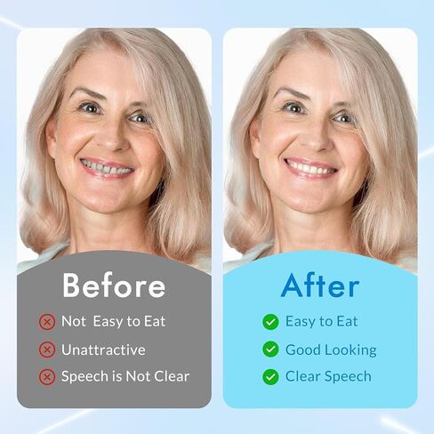 أسنان صناعية قابلة للتشكيل - أطقم أسنان من السيليكون - أسنان للرجال وقشرة أسنان للنساء - مجموعة مطابقة علوية وسفلية، مريحة وسريعة، مناسبة للاستخدام اليومي والحفلات - قطعة واحدة - MU6 in Kuwait