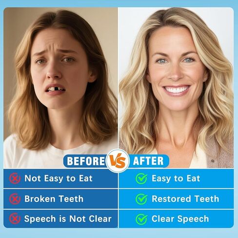 Moldable False Teeth - Silicone Dentures - Men and Veneers Teeth for Women - Upper and Lower Matching Set - Fix Your Smile at Within Minutes - Blue - 1PCS - S77 in Kuwait