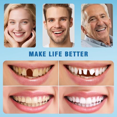 Moldable False Teeth - Silicone Dentures - Men and Veneers Teeth for Women - Upper and Lower Matching Set - Fix Your Smile at Within Minutes - Blue - 1PCS - S77 in Kuwait