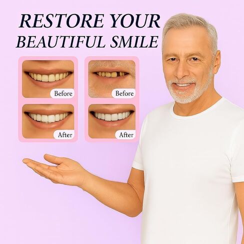 طقم أسنان تجميلي DIY مع مادة اللثة - مجموعة كاملة من الأسنان المزخرفة العلوية والسفلية القابلة للتشكيل، محسن الابتسامة البصرية المؤقتة للرجال والنساء في المنزل in Kuwait