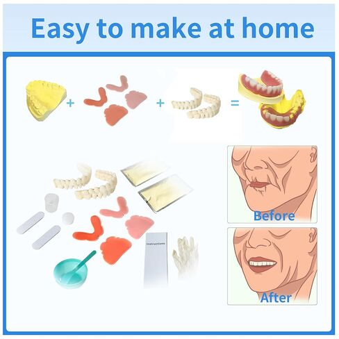 طقم أسنان مكون من 12 قطعة، مجموعتان (28 سنًا لكل مجموعة) من الأسنان الصناعية بأحجام مختلفة، للأسنان الصناعية الكاملة أو الجزئية، تتضمن جميع اللوازم اللازمة لصنع أطقم الأسنان العلوية والسفلية في المنزل. in Kuwait