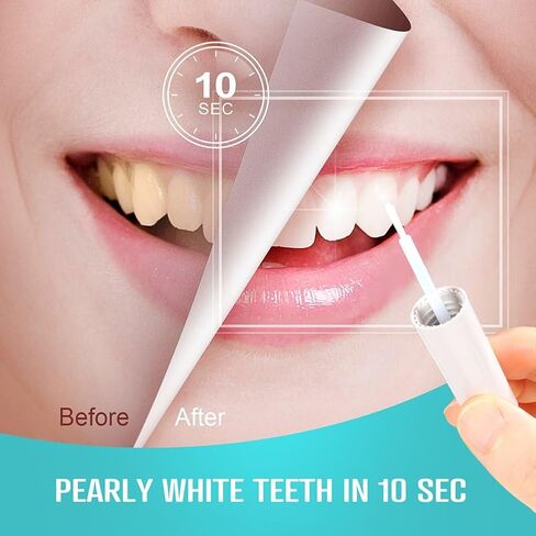 Tooth Whitening Paint - Instant White Teeth, Gentle & Safe Formula, Easy to Use & Portable, Long-Lasting Results for a Confident Smile in Kuwait