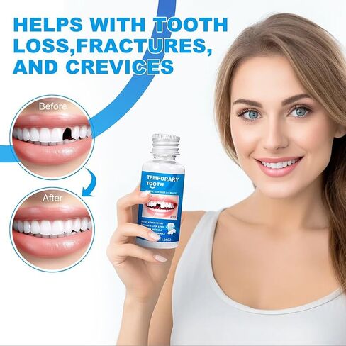 طقم أسنان من الخرز الحراري القابل للتشكيل، غطاء فجوة الأسنان المؤقتة للأسنان المكسورة أو المفقودة، استخدام المظهر التجميلي in Kuwait