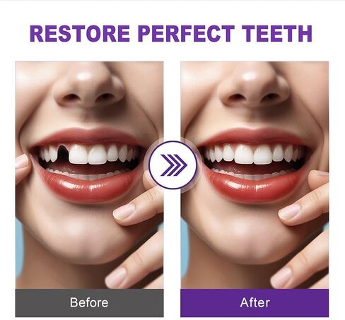 مجموعة خرز الأسنان القابلة للتشكيل، غطاء فجوة الأسنان المؤقتة للأسنان المفقودة، إكسسوار مظهر الأسنان التجميلي in Kuwait