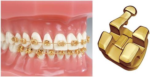 دعامة J&J Ortho Dorada المطلية بالذهب MBT/Roth (قياسي Roth 022 345H) in Kuwait