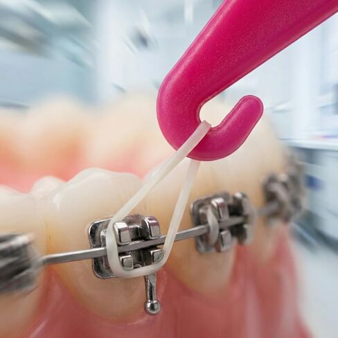 50 قطعة من أداة الشريط المطاطي لتقويم الأسنان، أدوات تقويم الأسنان المرنة الملونة للاستعمال مرة واحدة، أداة تثبيت الأسنان البلاستيكية لتقويم الأسنان مع خطاف ودفع للرجال والنساء - ألوان مختلطة in Kuwait