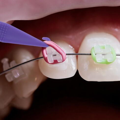 50 قطعة من أداة الشريط المطاطي لتقويم الأسنان، أدوات تقويم الأسنان المرنة الملونة للاستعمال مرة واحدة، أداة تثبيت الأسنان البلاستيكية لتقويم الأسنان مع خطاف ودفع للرجال والنساء - ألوان مختلطة in Kuwait
