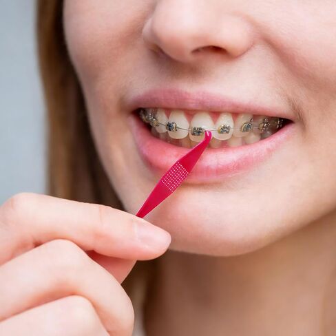 50 قطعة من أداة الشريط المطاطي لتقويم الأسنان، أدوات تقويم الأسنان المرنة الملونة للاستعمال مرة واحدة، أداة تثبيت الأسنان البلاستيكية لتقويم الأسنان مع خطاف ودفع للرجال والنساء - ألوان مختلطة in Kuwait