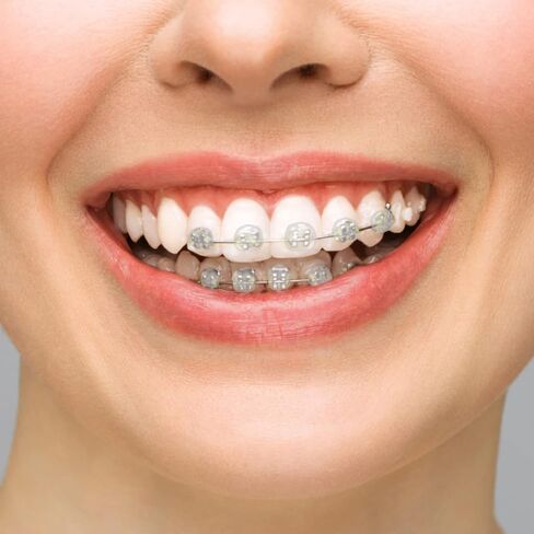 شمع تقويم الأسنان من بي في إن: 10 صناديق شرائح شمع لتقويم الأسنان، شمع تقويم الأسنان للأسنان، شمع أورثو للأقواس، شمع الأسنان، شمع الفم، شمع الفم للأقواس، شمع تخفيف لمرضى التقويم الذين يرتدون التقويم in Kuwait