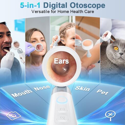 Otoscope Ear Camera with Light, 1.4" Screen 1080P HD Ear Scope, 12 Silicone Specula Tips, Photo & Video Recording, Type-C Rechargeable, Ear Cleaning Camera for Adult Kid and Pet in Kuwait